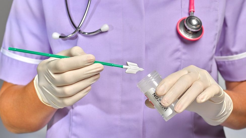 Cervical screening procedure